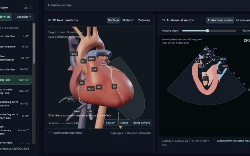 Anesthbeta TEE Simulator: the long-axis preset, 3D heart and section side by side.