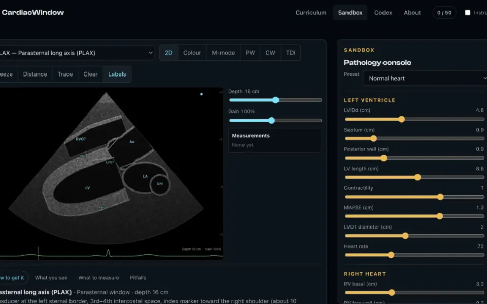 CardiacWindow: the sandbox in parasternal long-axis view with depth, gain and measurement tools.