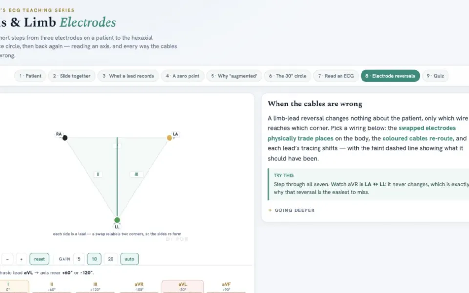 CardioRender Einthoven's Triangle: the electrode reversal lesson with the live lead panel.