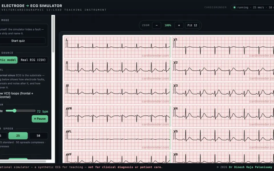 CardioRender Electrode to ECG: the live simulator with reversal, gain and artifact controls.