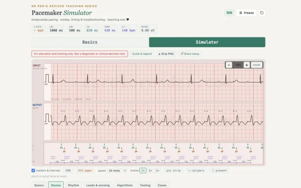 CardioRender Pacemaker Simulator in DDD mode with its timing readouts.