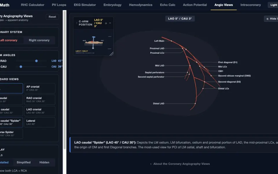 CathMath Coronary Angiography Views: the LAO caudal spider preset.