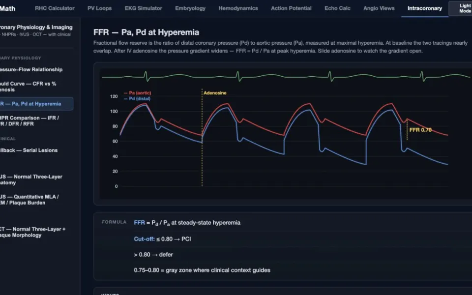CathMath Intracoronary Physiology: the FFR lesson at full modeled hyperemia.
