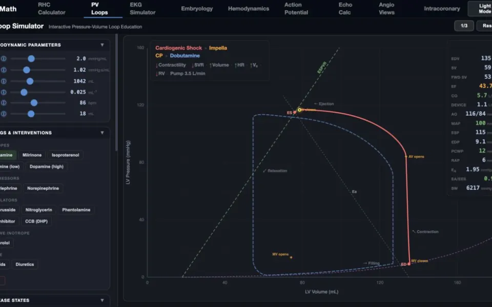 CathMath PV Loop Simulator with an example scenario loaded.