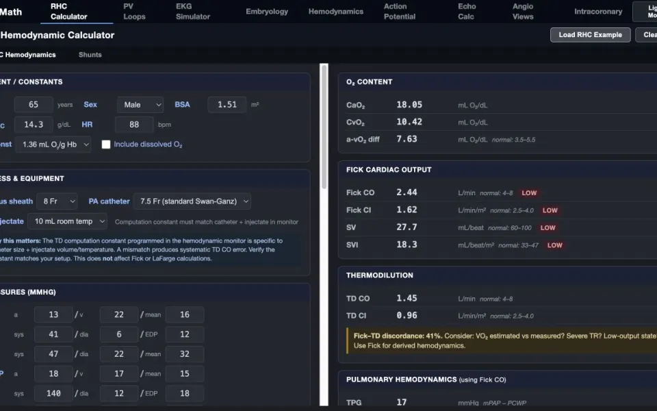 CathMath RHC calculator with the built-in example loaded.