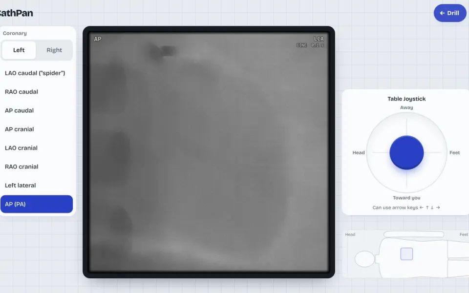 CathPan: a fluoroscopy frame with the panning joystick and the lab-position map.
