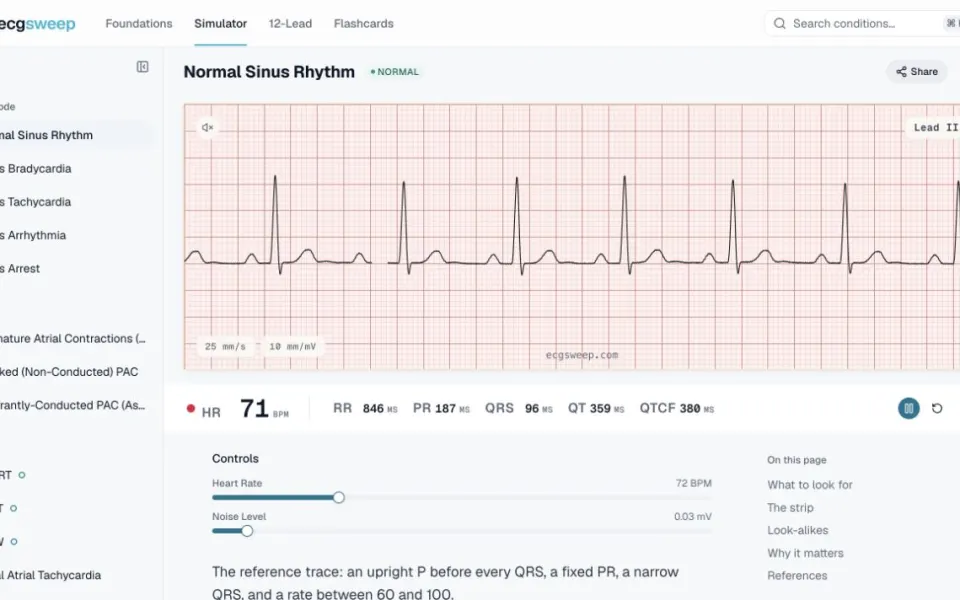 ECG Sweep: a sweeping rhythm trace with the rhythm selector.