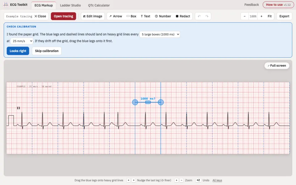 ECG Toolkit: an example tracing with blue calipers set across five large boxes for calibration.