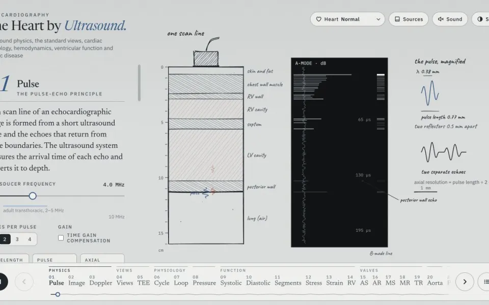 Intro2Echo: a pulse-echo physics lesson with an ultrasound sector image and sliders.