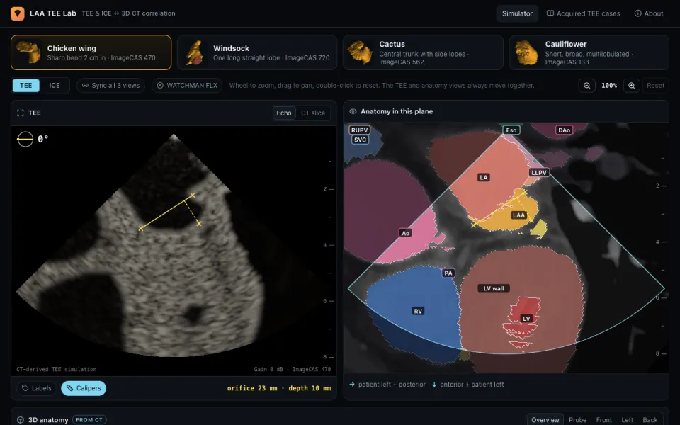 LAA TEE Lab: a simulated TEE image beside a colored CT slice of the left atrial appendage.