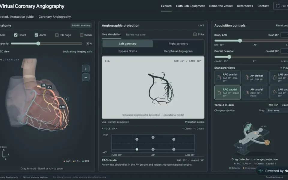LearnCoronary: 3D coronary anatomy beside its live angiographic projection and the acquisition controls.