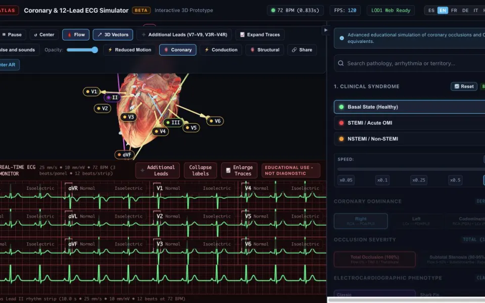 MioAtlas: a 3D heart with its coronary tree and a synthetic 12-lead ECG below.