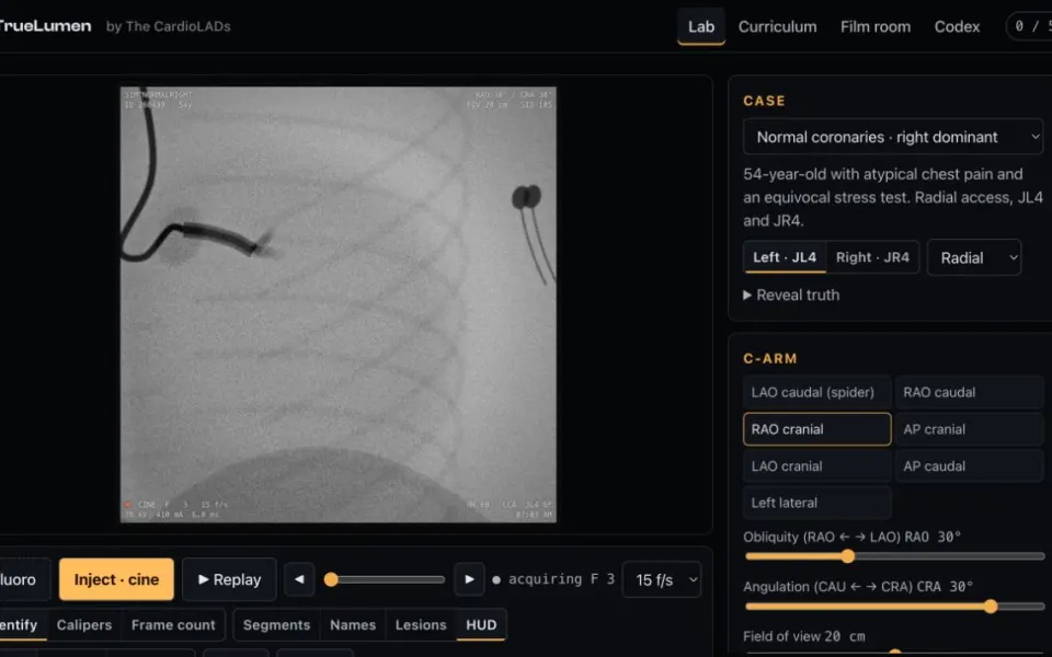 TrueLumen: the angiography lab during a synthetic cine run.